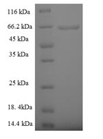Recombinant Human 5'-3' exonuclease PLD4 (PLD4), partial – Figure 1 of 1