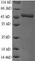 Recombinant Human DCN1-like protein 1 (DCUN1D1) – Figure 1 of 1