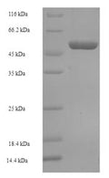 Recombinant Human Oxidoreductase NAD-binding domain-containing protein 1 (OXNAD1) – Figure 1 of 1