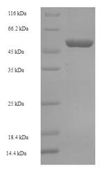 Recombinant Human Oxidoreductase NAD-binding domain-containing protein 1 (OXNAD1) – Figure 1 of 1