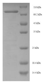 Recombinant Human Centrosomal protein of 63KDA (CEP63) – Figure 1 of 1