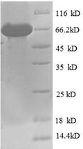 Recombinant Human Bile acid receptor (NR1H4) – Figure 1 of 1