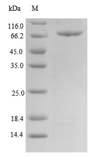 Recombinant Human T-box transcription factor TBX15 (TBX15) – Figure 1 of 1