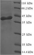 Recombinant Human Nicotinamide mononucleotide adenylyltransferase 3 (NMNAT3) – Figure 1 of 1