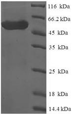 Recombinant Human Sex comb on midleg-like protein 4 (SCML4) – Figure 1 of 1