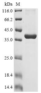 (Tris-Glycine gel) Discontinuous SDS-PAGE (reduced) with 5% enrichment gel and 15% separation gel.