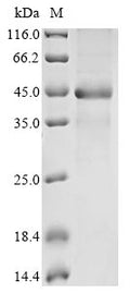 (Tris-Glycine gel) Discontinuous SDS-PAGE (reduced) with 5% enrichment gel and 15% separation gel.