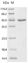 (Tris-Glycine gel) Discontinuous SDS-PAGE (reduced) with 5% enrichment gel and 15% separation gel.