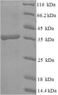 Recombinant Human C-type lectin domain family 4 member D (CLEC4D), partial – Figure 1 of 1