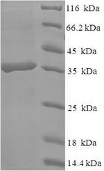 Recombinant Human C-type lectin domain family 4 member D (CLEC4D), partial – Figure 1 of 1