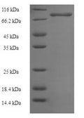 Recombinant Human Phosphoinositide 3-kinase regulatory subunit 5 (PIK3R5) – Figure 1 of 1