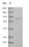 (Tris-Glycine gel) Discontinuous SDS-PAGE (reduced) with 5% enrichment gel and 15% separation gel.