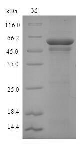 (Tris-Glycine gel) Discontinuous SDS-PAGE (reduced) with 5% enrichment gel and 15% separation gel.