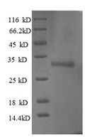 Recombinant Human Ubiquitin-conjugating enzyme E2 W (UBE2W) – Figure 1 of 1