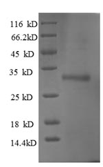 Recombinant Human Ubiquitin-conjugating enzyme E2 W (UBE2W) – Figure 1 of 1