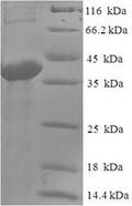 Recombinant Human Abhydrolase domain-containing protein 14B (ABHD14B) – Figure 1 of 1