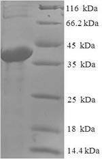 Recombinant Human Abhydrolase domain-containing protein 14B (ABHD14B) – Figure 1 of 1