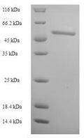 Recombinant Human Retinol dehydrogenase 12 (RDH12) – Figure 1 of 1