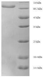 Recombinant Human D-2-hydroxyglutarate dehydrogenase, mitochondrial (D2HGDH) – Figure 1 of 1