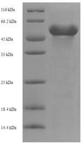 Recombinant Human Kynurenine/alpha-aminoadipate aminotransferase, mitochondrial (AADAT) – Figure 1 of 1