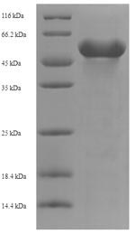 Recombinant Human Kynurenine/alpha-aminoadipate aminotransferase, mitochondrial (AADAT) – Figure 1 of 1