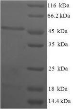 Recombinant Human Estradiol 17-beta-dehydrogenase 11 (HSD17B11) – Figure 1 of 1