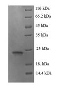 Recombinant Mouse Angiopoietin-like protein 8 (Angptl8) – Figure 1 of 1