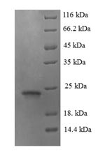 Recombinant Mouse Angiopoietin-like protein 8 (Angptl8) – Figure 1 of 1
