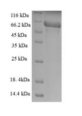 Recombinant Mouse Transmembrane protease serine 4 (Tmprss4), partial – Figure 1 of 1