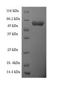 Recombinant Human Scavenger receptor class B member 1 (SCARB1), partial – Figure 1 of 1