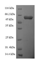 Recombinant Human Scavenger receptor class B member 1 (SCARB1), partial – Figure 1 of 1