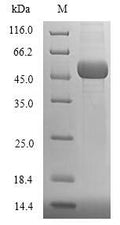 Recombinant Human Ubiquitin-conjugating enzyme E2 Q2 (UBE2Q2) – Figure 1 of 1