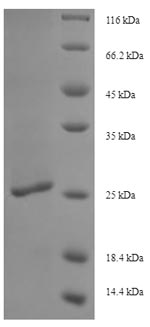 Recombinant Salmonella typhi LPS-assembly protein LptD (lptD), partial – Figure 1 of 1
