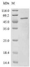 Recombinant Mouse Interferon-inducible protein AIM2 (Aim2) – Figure 1 of 1