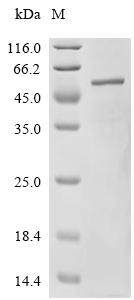 Recombinant Mouse Interferon-inducible protein AIM2 (Aim2) – Figure 1 of 1