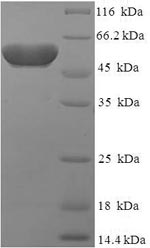 Recombinant Human Protein atonal homolog 1 (ATOH1) – Figure 1 of 1