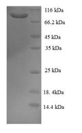 Recombinant Human GRIP and coiled-coil domain-containing protein 1 (GCC1), partial – Figure 1 of 1