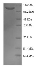 Recombinant Human GRIP and coiled-coil domain-containing protein 1 (GCC1), partial – Figure 1 of 1