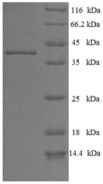 Recombinant Human Pleckstrin homology domain-containing family B member 2 (PLEKHB2) – Figure 1 of 1
