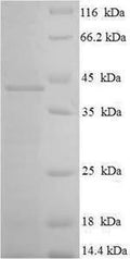 Recombinant Human Ras-related protein Rab-3C (RAB3C) – Figure 1 of 1