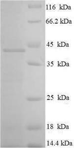 Recombinant Human Ras-related protein Rab-3C (RAB3C) – Figure 1 of 1