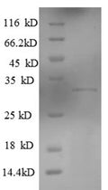 Recombinant Human Killer cell lectin-like receptor subfamily G member 1 (KLRG1), partial – Figure 1 of 1