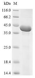 (Tris-Glycine gel) Discontinuous SDS-PAGE (reduced) with 5% enrichment gel and 15% separation gel.