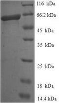 Recombinant Human Endonuclease 8-like 1 (NEIL1) – Figure 1 of 1