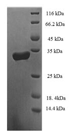 Recombinant Human Probable D-tyrosyl-tRNA (Tyr) deacylase 2 (DTD2) – Figure 1 of 1