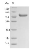 Recombinant Human Succinyl-CoA ligase [GDP-forming] subunit beta, mitochondrial (SUCLG2), partial – Figure 1 of 1