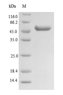 Recombinant Human Succinyl-CoA ligase [GDP-forming] subunit beta, mitochondrial (SUCLG2), partial – Figure 1 of 1