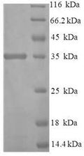 Recombinant Human Protein disulfide-isomerase TMX3 (TMX3) – Figure 1 of 1