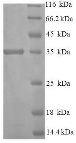 Recombinant Human Protein disulfide-isomerase TMX3 (TMX3) – Figure 1 of 1