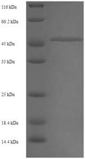 Recombinant Human CAS1 domain-containing protein 1 (CASD1), partial – Figure 1 of 1